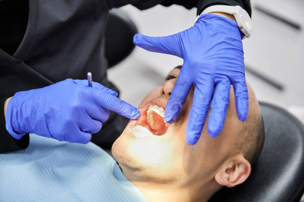 Best Knocked-Out Tooth Emergency  in Homestead Meadows South, TX